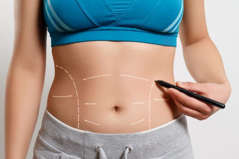 7 Myths About Tummy Tucks In 2022 - Dr. Cat Begovic