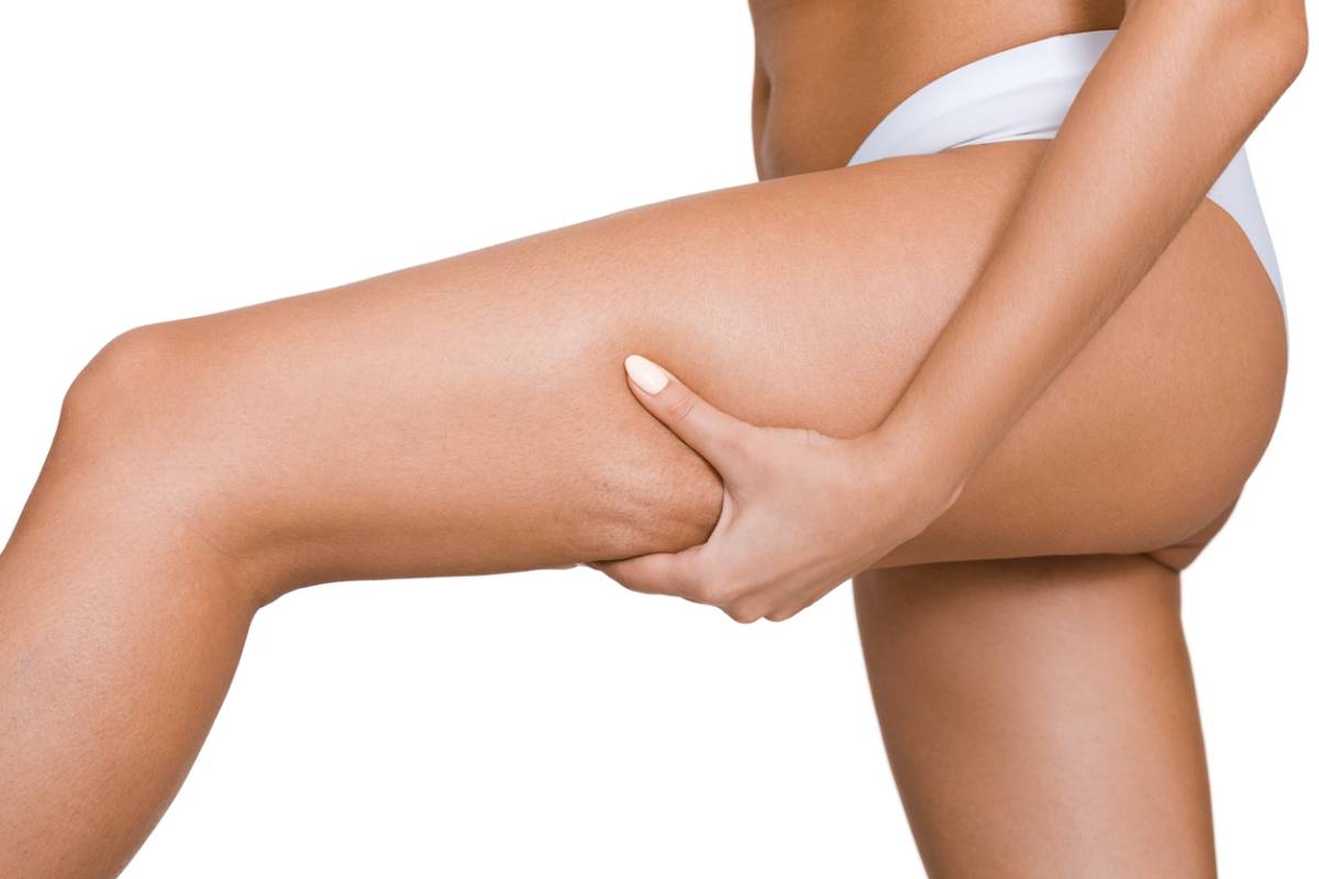 Seven ways to reduce cellulite