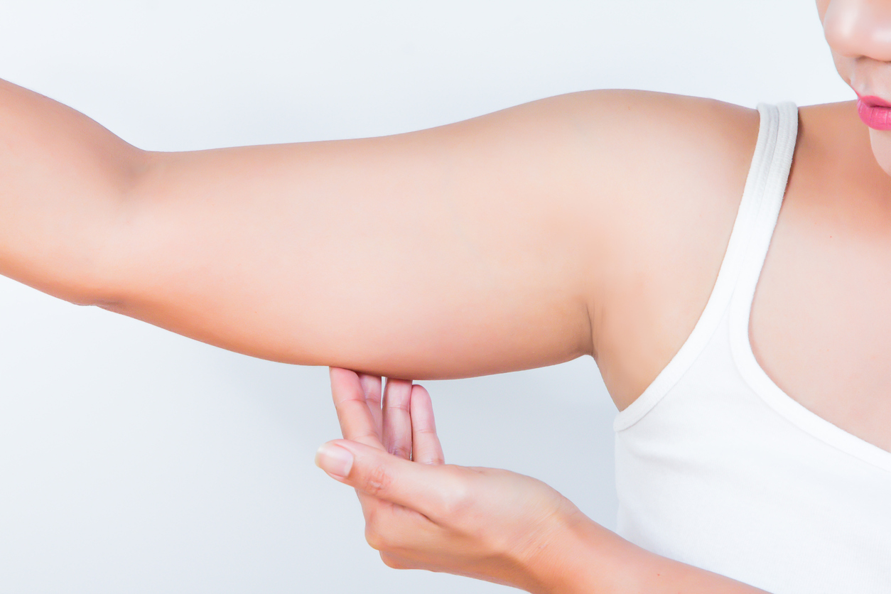 asian woman showing her fat upper arm